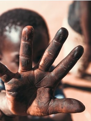 Generating Pity: The Politics of Poverty